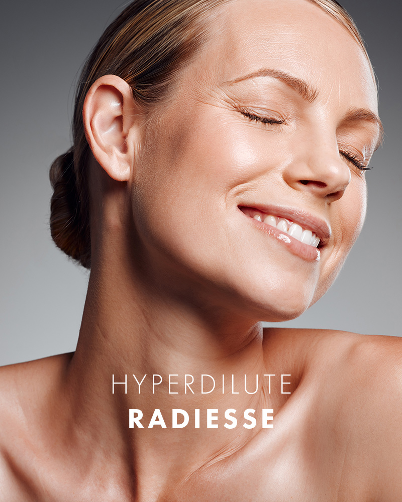 MMS_HyperdiluteRadiesse