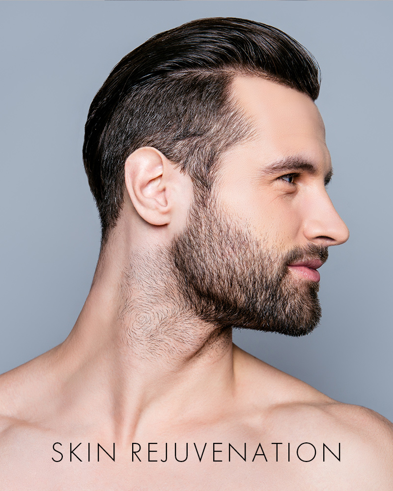 MMS_SkinRejuvenation