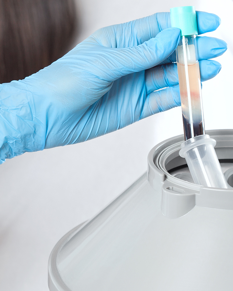 Platelet Rich Plasma, PRP, collagen, plasma, skin,